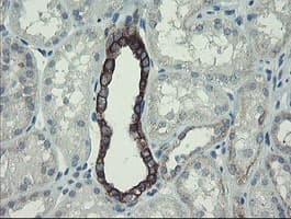 DPH2 Antibody (clone OTI3A12)