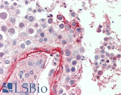 IHC-plus™ FBLN2 / Fibulin 2 Antibody (210-290 aa, Internal)