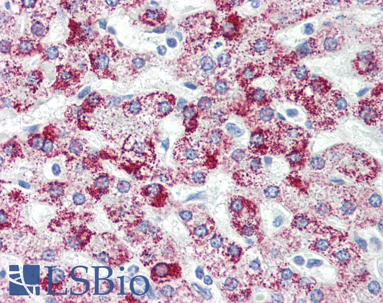 PathPlus™ HSPD1 / HSP60 Antibody (aa1-573, clone 2E4)