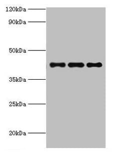 Polyclonal Rabbit anti-Human RRM2B / P53R2 Antibody (aa1-351, IHC, WB)