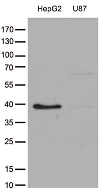 GALM / Mutarotase Antibody (clone OTI4F4)