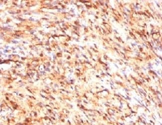 Monoclonal Mouse anti-Human S100B / S100 Beta Antibody (clone PS1B1-1, Azide-free,BSA-free, IHC, IF)