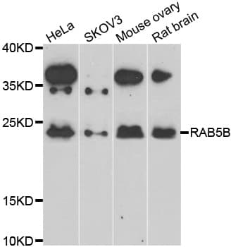 RAB5B Antibody