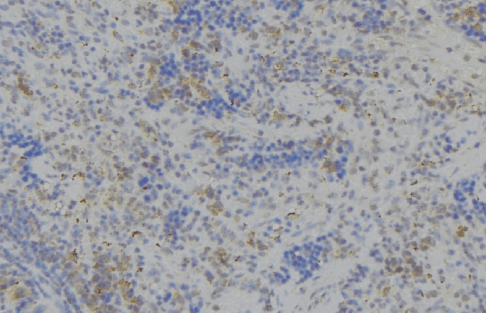 LILRB2 / ILT4 Antibody