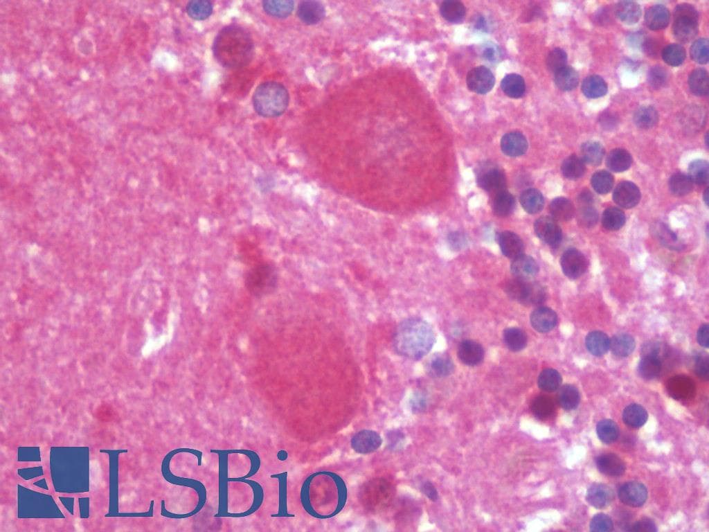 IHC-plus™ Polyclonal Rabbit anti-Human APPBP2 Antibody (IHC, IF, WB)