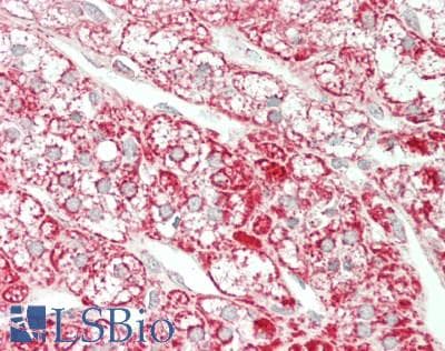 IHC-plus™ PHB / Prohibitin Antibody (clone 5H7)