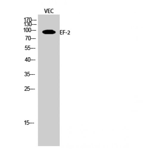 EEF2 / Elongation Factor 2 Antibody (1-80 aa)