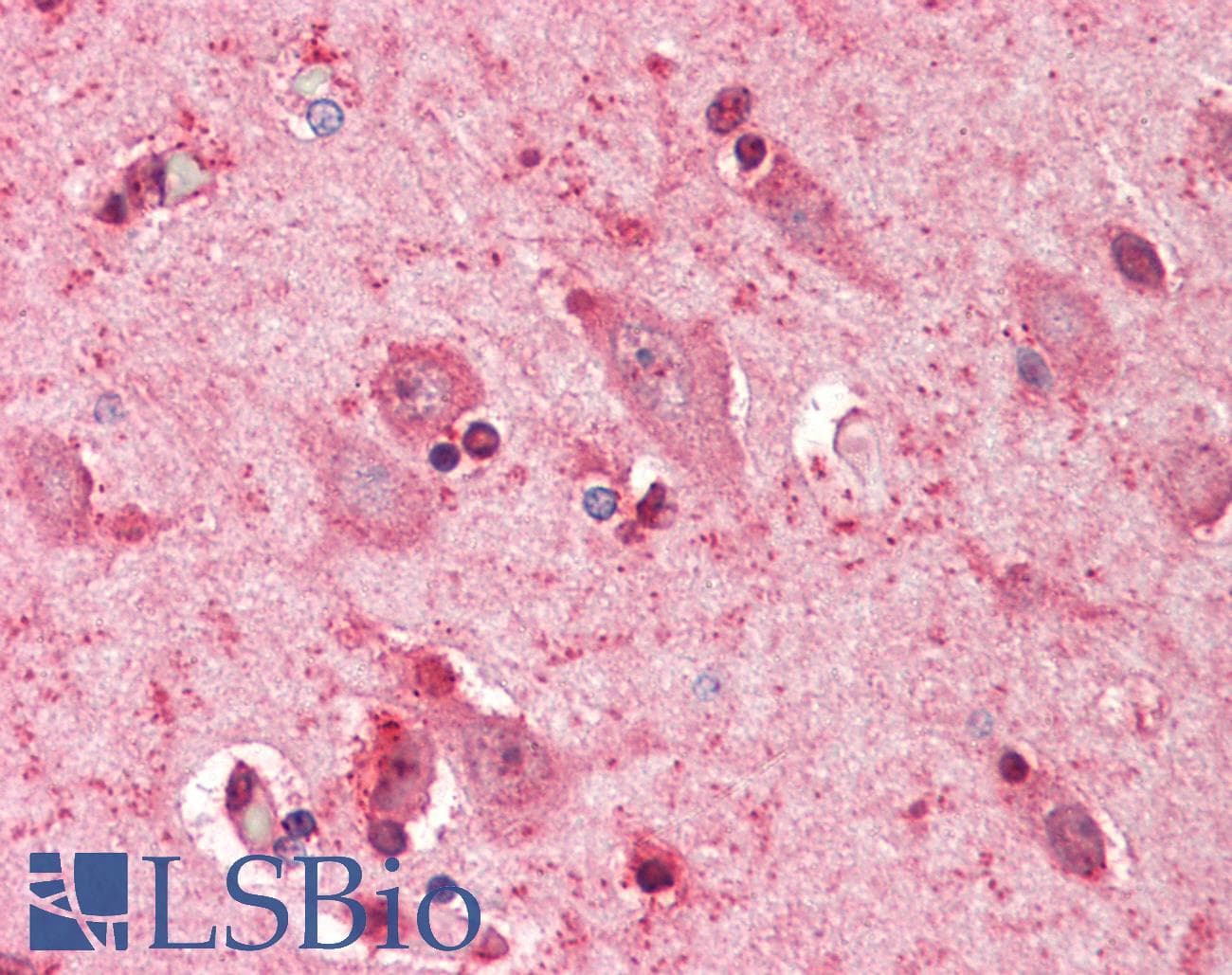 IHC-plus™ OPRL1 / ORL1 Antibody