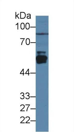 CYP2E1 Antibody (aa126-309)