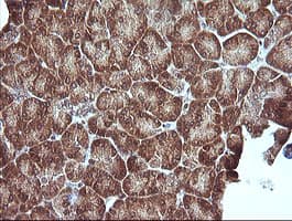 MAP2K1 / MKK1 / MEK1 Antibody (clone OTI2G5, Carrier-free)