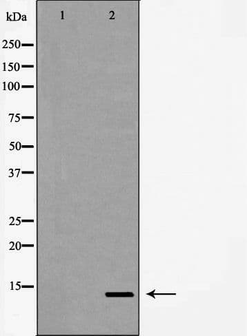Polyclonal Rabbit anti-Human SNCB / Beta-Synuclein Antibody (IHC, IF, WB)