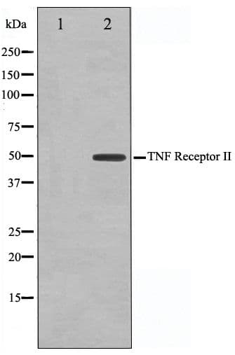 Polyclonal Rabbit anti-Human TNFRSF1B / TNFR2 Antibody (IF, WB)