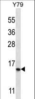 Polyclonal Rabbit anti-Human NR2C2AP / TRA16 Antibody (aa8-37, WB)