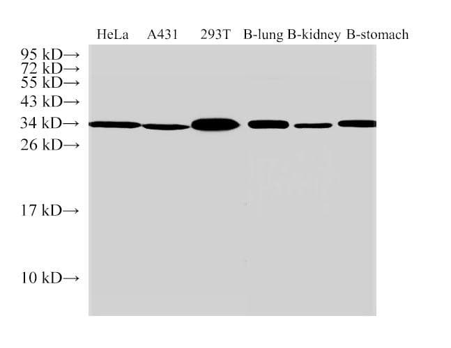 ANXA5 / Annexin V Antibody