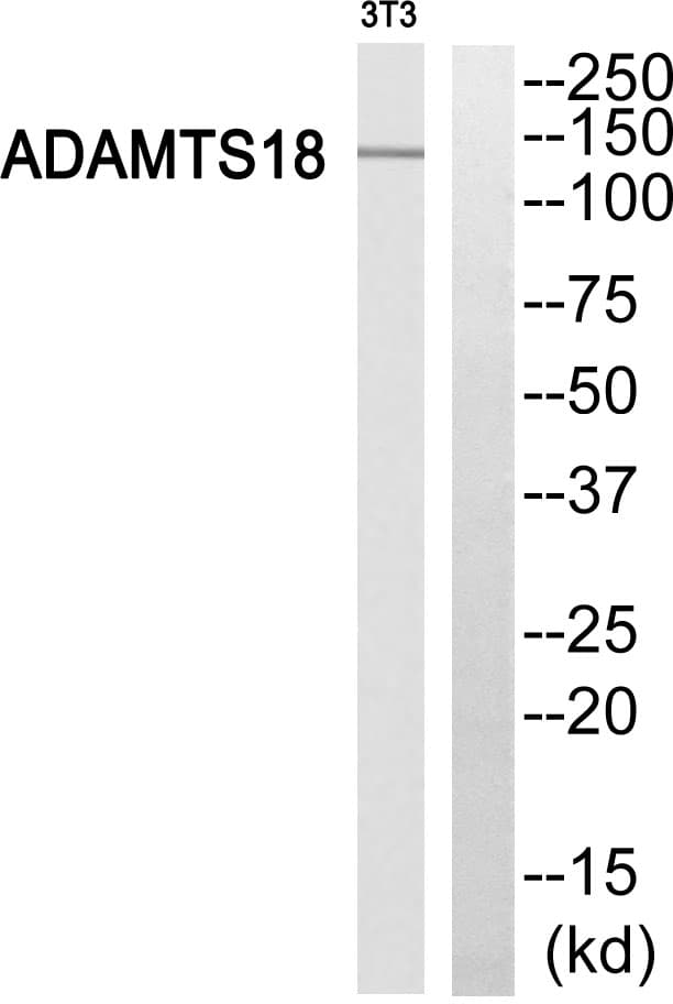 Polyclonal Rabbit anti-Human ADAMTS18 Antibody (WB)