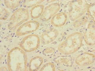 DNA2 Antibody