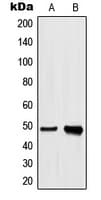 hnRNP H1+H2 Antibody (Internal)