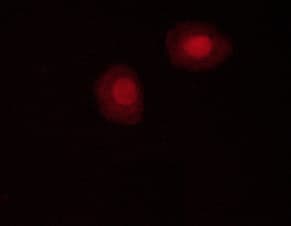 PRKAA1 / AMPK Alpha 1 Antibody (phospho-Thr172)