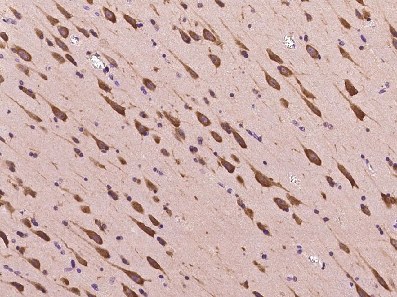 Polyclonal Rabbit anti-Human CCDC124 Antibody (IHC, IF)