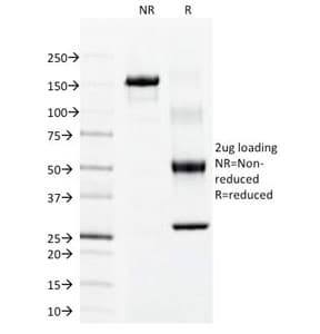 KRT15 / CK15 / Cytokeratin 15 Antibody (clone LHK15)