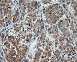 LIPG / Endothelial Lipase Antibody (clone OTI6E11)
