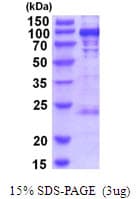 Human PYGL Protein (Recombinant His)