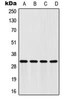 Polyclonal Rabbit anti-Human FHL2 Antibody (Internal, WB)