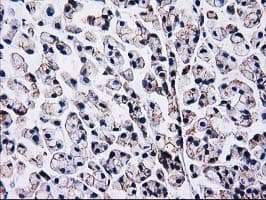 CTNNB1 / Beta Catenin Antibody (clone OTI9H2, Carrier-free)