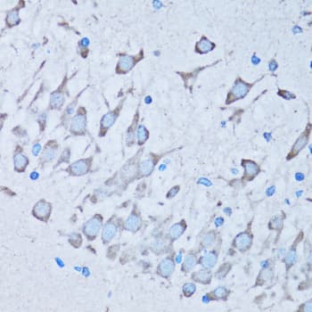 Polyclonal Rabbit anti-Human NNMT Antibody (IHC, IF, WB)