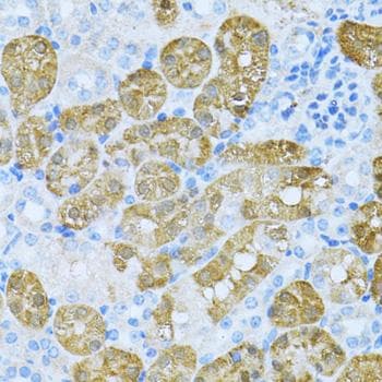 KLHL42 / KLHDC5 Antibody