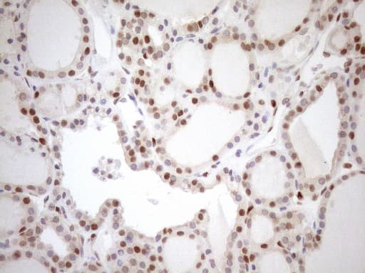 MGMT Antibody (clone OTI2E2)