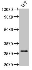 IHC-plus™ Polyclonal Rabbit anti-Human PRSS3 / Trypsin 3 Antibody (aa81-303, IHC, WB)