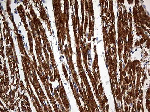 SH3BGR Antibody (clone OTI4G5)