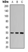 Polyclonal Rabbit anti-Human TUBB3 / Tubulin Beta 3 Antibody (IHC, WB)