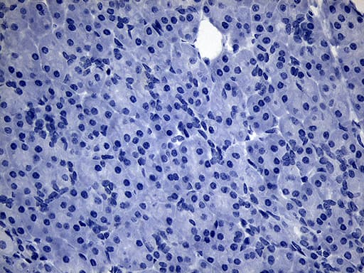 PDCL3 Antibody (clone OTI10A6)