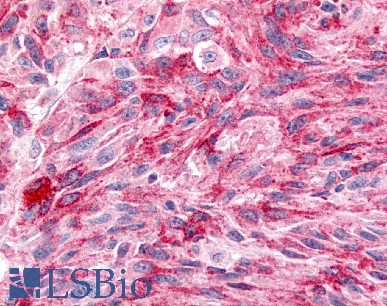 PathPlus™ WNT8A Antibody (Internal)