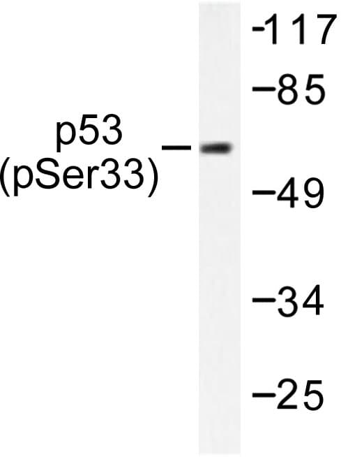 TP53 / p53 Antibody (phospho-Ser33)