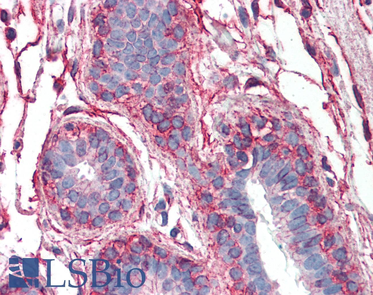 IHC-plus™ PAK1 Antibody (clone 1E11)