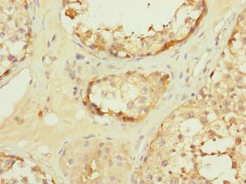 TOMM34 Antibody