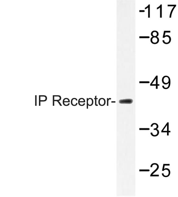 PTGIR / IP Receptor Antibody (His237)