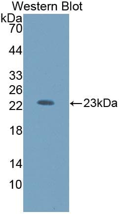 HEXB Antibody (aa122-311)