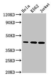 PHF6 Antibody (aa2-312)