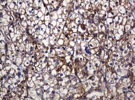 Monoclonal Mouse anti-Human POGK Antibody (clone OTI3E2, IHC, WB)