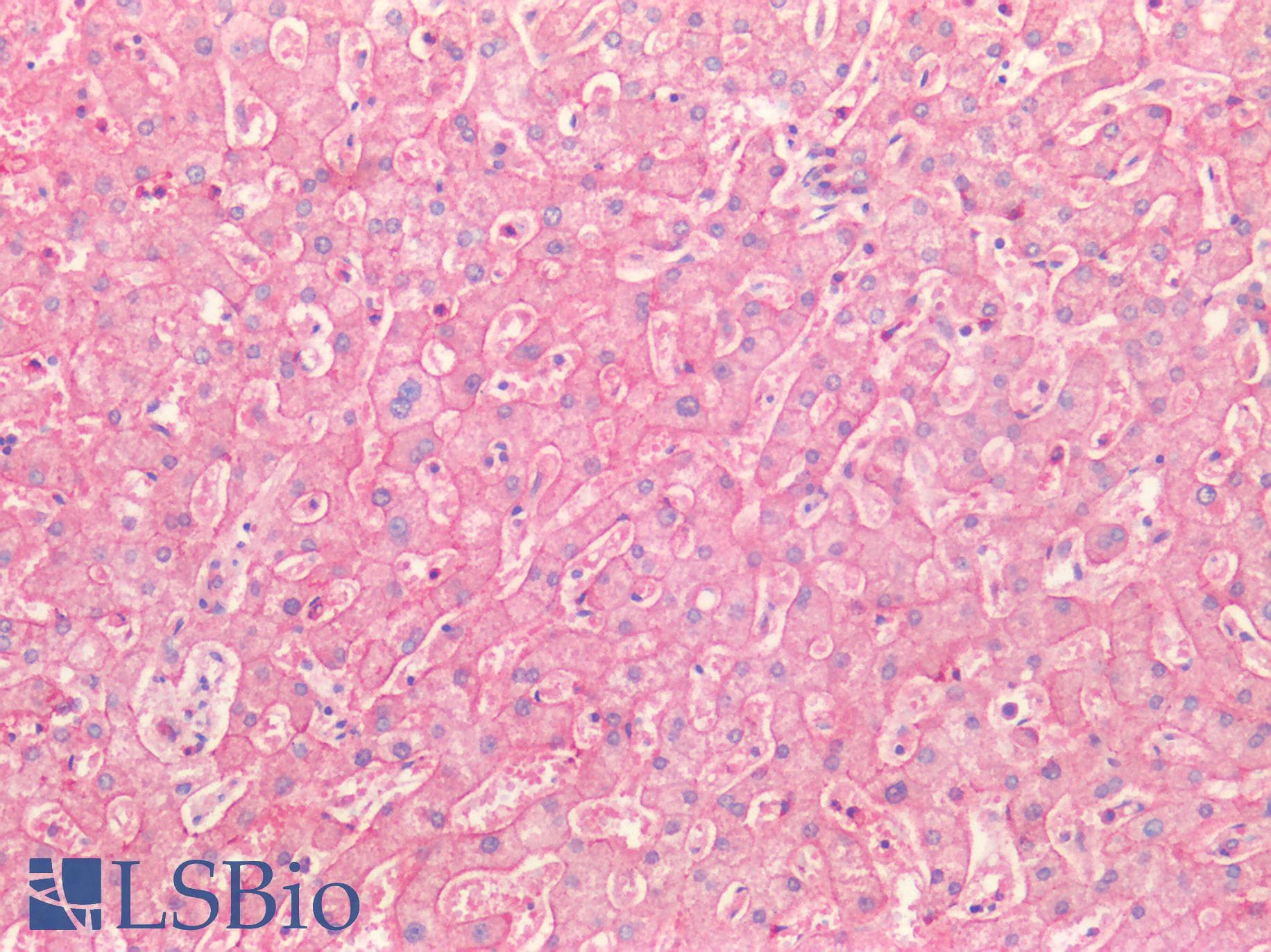 PathPlus™ Polyclonal Rabbit anti-Human CDH1 / E Cadherin Antibody (IHC)