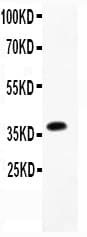 FCER2 / CD23 Antibody (aa50-331)