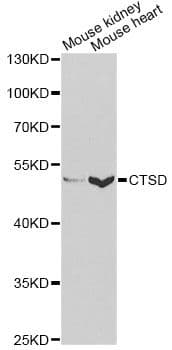 CTSD / Cathepsin D Antibody