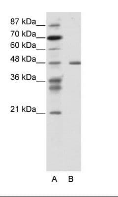 Polyclonal Rabbit anti-Human PSMC2 / RPT1 Antibody (N-Terminus, WB)