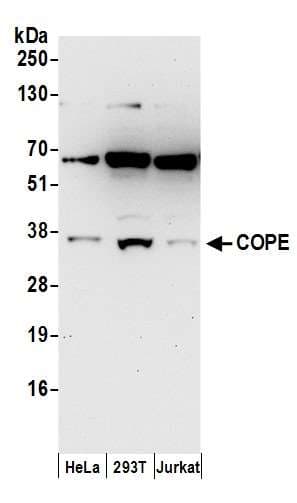 COPE Antibody (aa1-50)