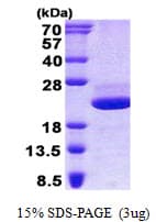 Human LGALSL / Galectin 5 Protein (Recombinant His)