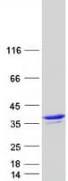 Human ANXA4 / Annexin IV Protein (Recombinant Myc-DDK (Flag))